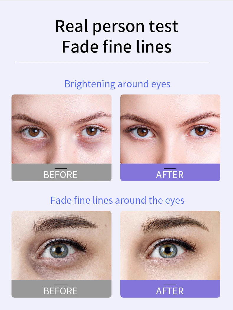 Crème yeux anti-rides O'CHEAL avec applicateur roll-on