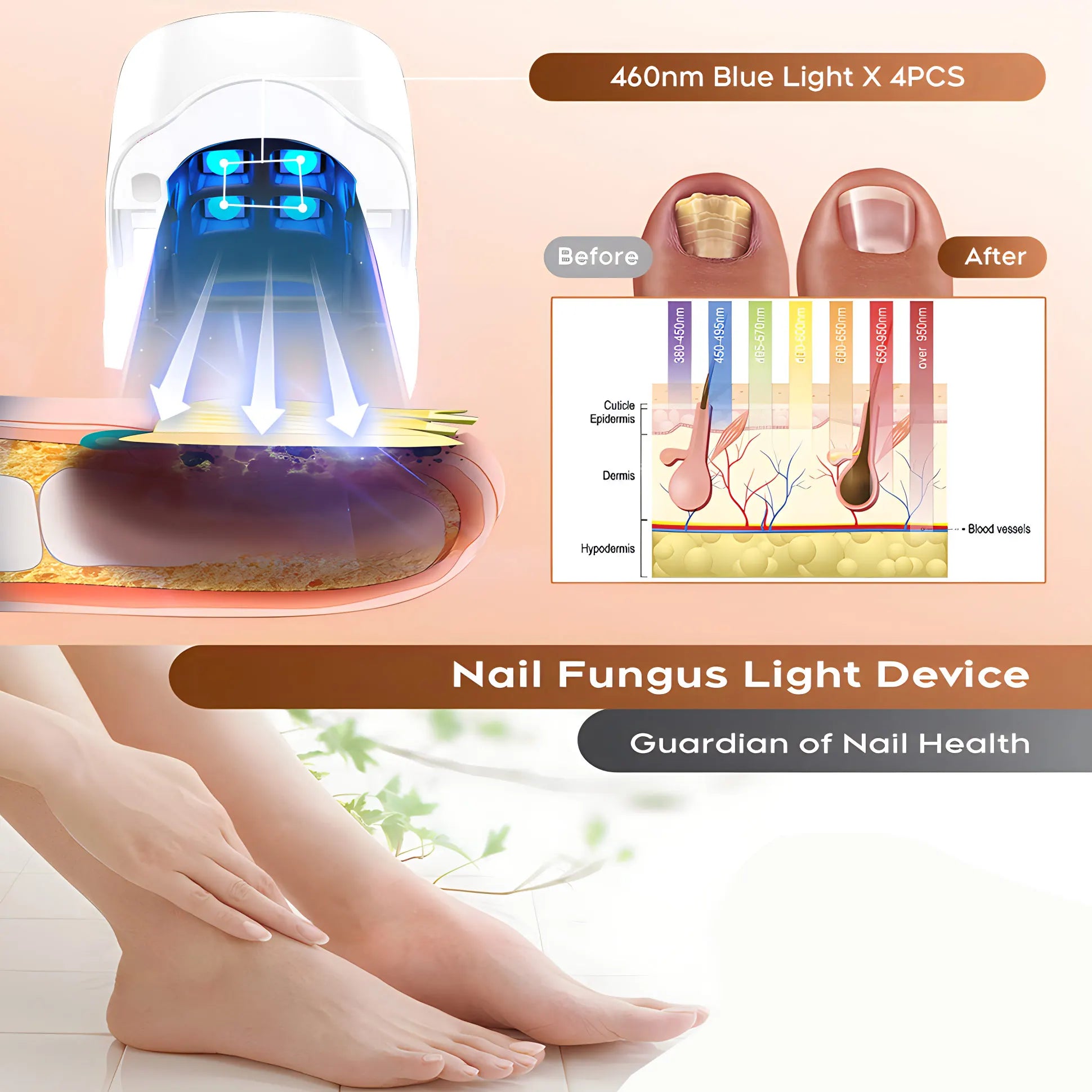 Appareil Laser Antifongique pour Ongles – Élimine les Champignons et Répare les Ongles Abîmés