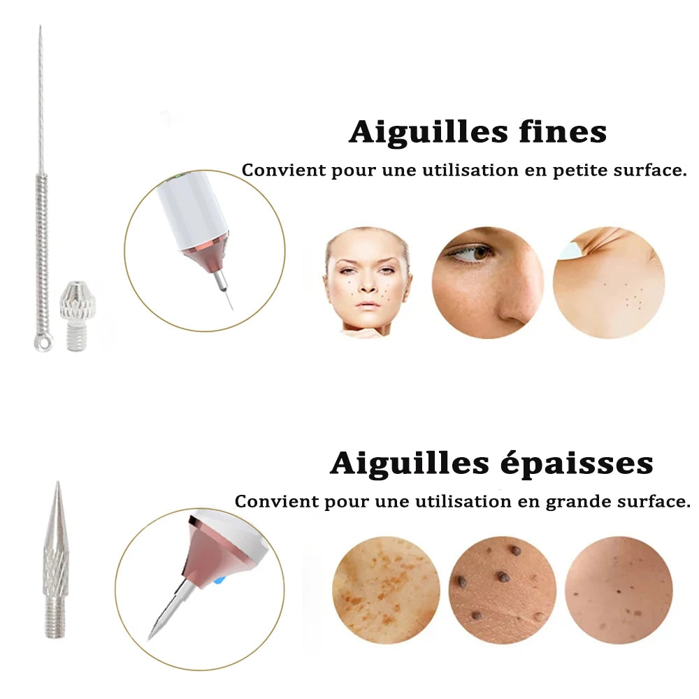 Stylo Électrique d'Élimination des Verrues et Acrochordons – Stylo Laser Plasma pour Éliminer Verrues, Papillomes, Taches Sombres, Grains de Beauté et Acrochordons