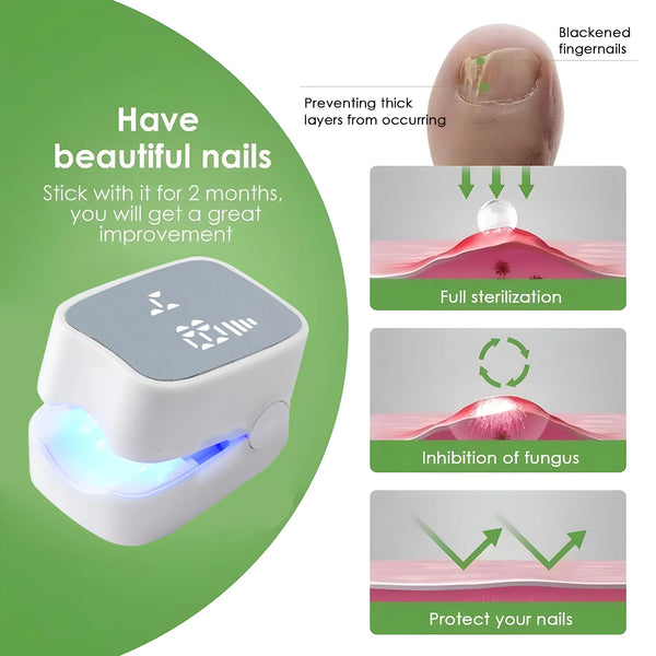 Appareil Laser Antifongique pour Ongles – Élimine les Champignons et Répare les Ongles Abîmés